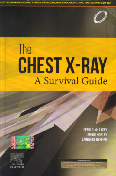 Chest X-Ray A Survival Guide 1st SAE/2008